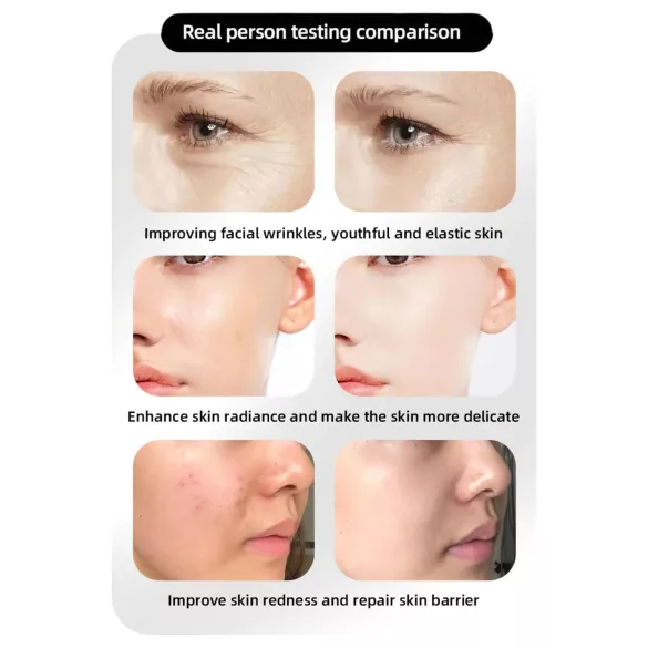 Photon Rejuvenation Μάσκα LED Αναζωογόνησης Προσώπου